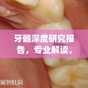牙髓深度研究报告，专业解读，洞悉细节
