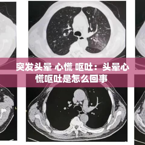 突发头晕 心慌 呕吐：头晕心慌呕吐是怎么回事 