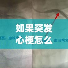 如果突发心梗怎么办：突发心梗会有什么症状 