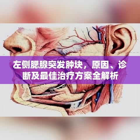左侧腮腺突发肿块，原因、诊断及最佳治疗方案全解析