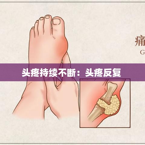 头疼持续不断：头疼反复 