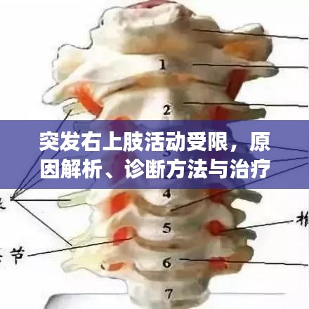 突发右上肢活动受限，原因解析、诊断方法与治疗方案全解析