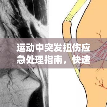 运动中突发扭伤应急处理指南，快速应对，保护健康！