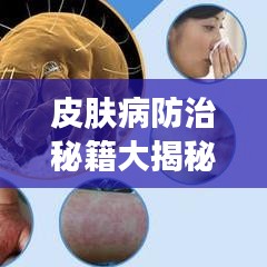 皮肤病防治秘籍大揭秘，专业实用方法助你轻松应对！