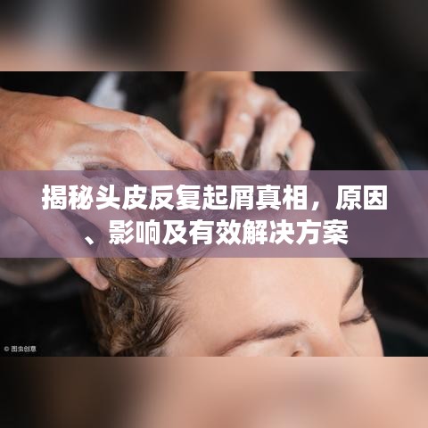 揭秘头皮反复起屑真相，原因、影响及有效解决方案
