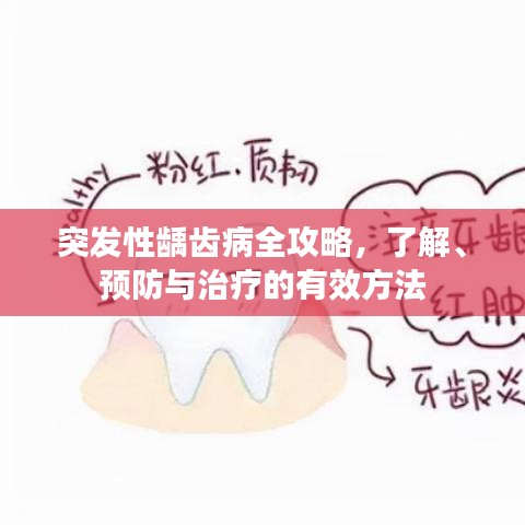 突发性龋齿病全攻略，了解、预防与治疗的有效方法
